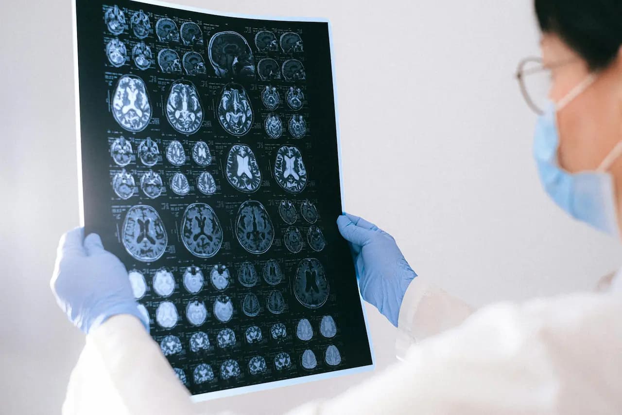 Miniatura artykułu Polskie laboratoria z sukcesem testują lek na Alzheimera – przełom w walce z chorobą